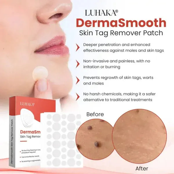 DermaSmooth Skin Tag Remover Patch – Fast, Safe & Painless Removal