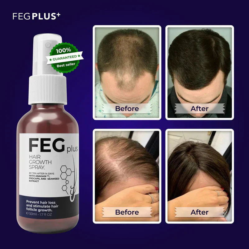 FEG Plus Hair Growth Spray – Revive, Strengthen & Transform